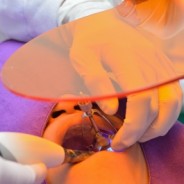 The Silent Killer In Your Mouth