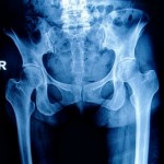 Annual Pelvic Exams Not Necessary For All Women