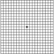 Telescopic Eye Implant for Macular Degeneration Received FDA Blessing