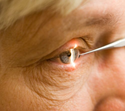 7 Warning Signs of Age-Related Eye Problems and What You Can Do