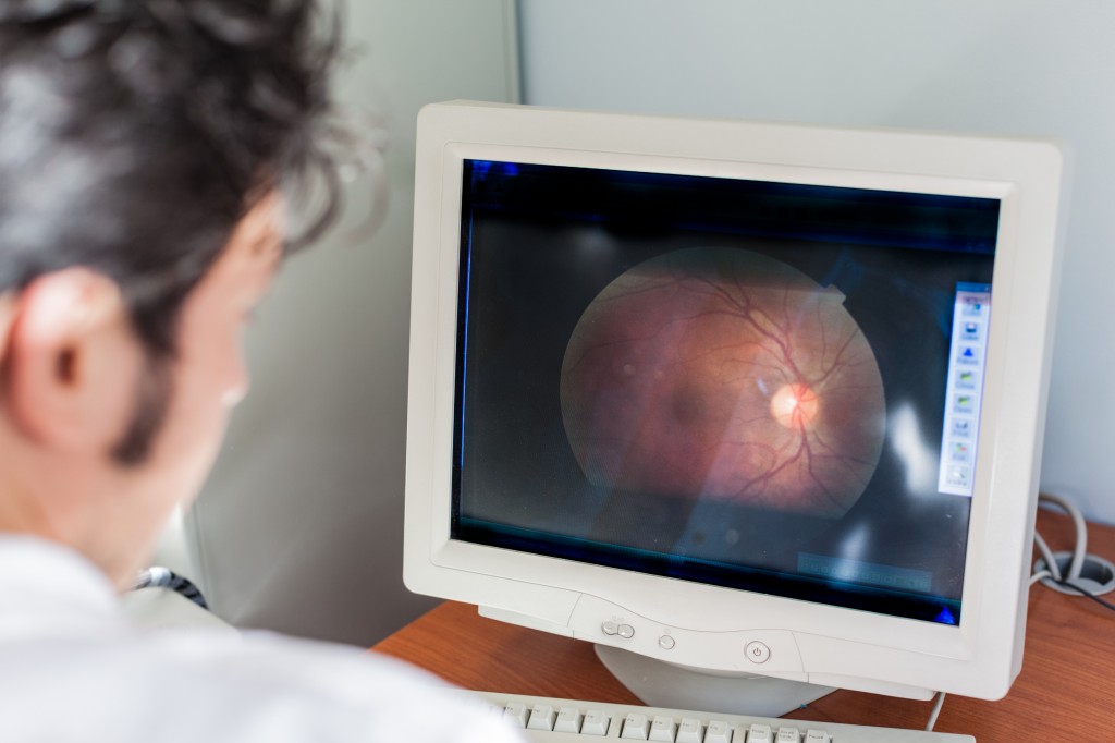 New Retinal Scan Predicts Macular Degeneration Progression