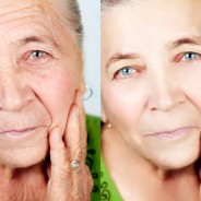 6 Natural Remedies To Reduce Skin Discoloration