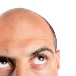 5 Natural Topical Remedies to Combat Baldness