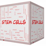 Unorthodox Stem Cell Treatment for Macular Degeneration