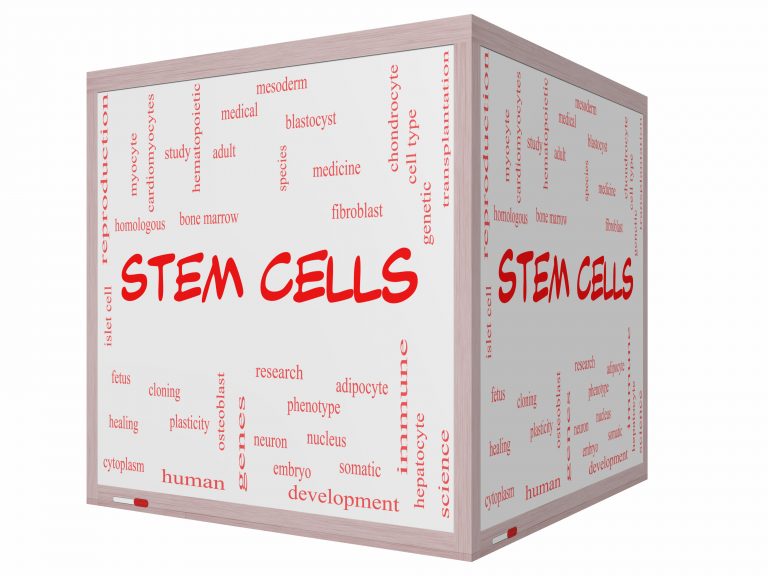 Unorthodox Stem Cell Treatment for Macular Degeneration