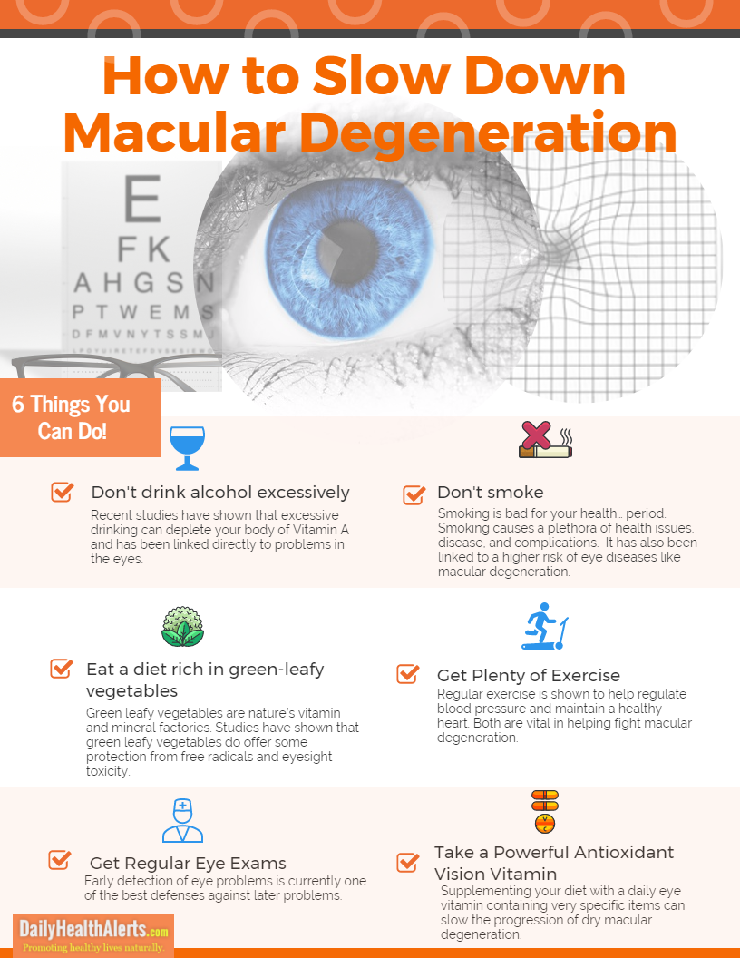 Infographic explains how to slow down macular degeneration.