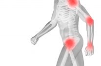 Lutein and Zeaxanthin for Vision