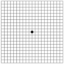 Macular Degeneration Chart Test