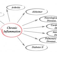 Importance of Macular Degeneration Support Groups | Daily Health Alerts