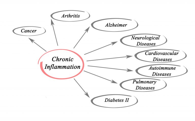 Cellular Inflammation Links to Macular Degeneration