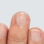 Your Fingernails May Be Telling You Something