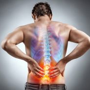 Natural Fixes for Sciatica
