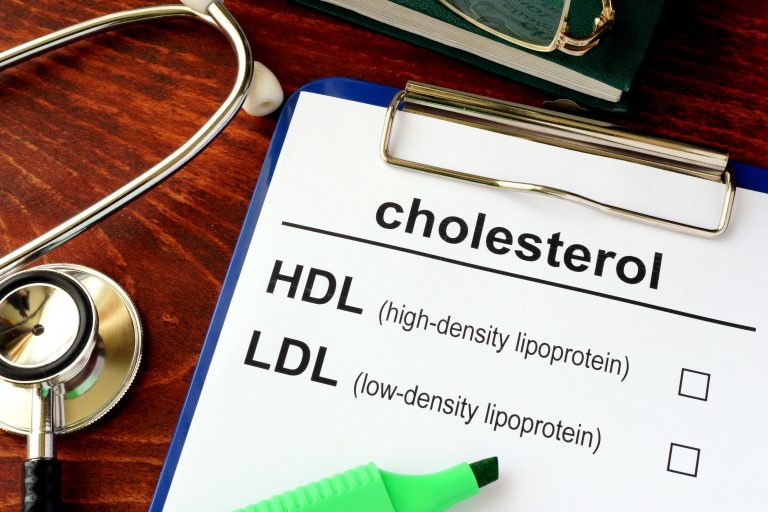 Good Cholesterol Causes Macular Degeneration
