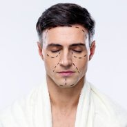 Workouts and Plastic Surgeries: 4 Things You Should Be Aware of