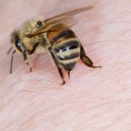 Bee Venom Therapy-Cure to Many Ailments?