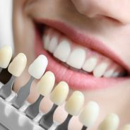 Cosmetic dentistry: Restore A Beautiful Smile