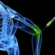Lipogems: Next Gen Joint Repair