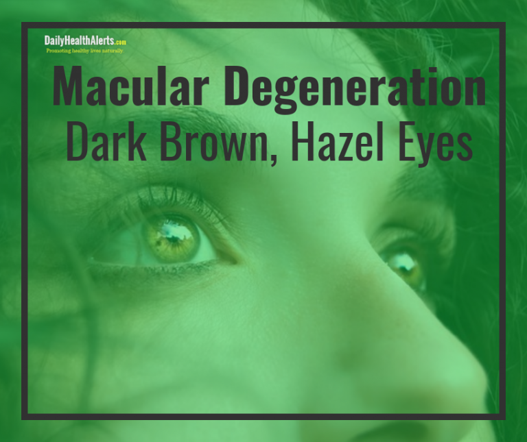 Macular Degeneration Dark Brown Eyes | Daily Health Alerts