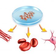 Storing Stem Cells May Save Your Life