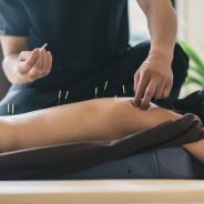 Treat Macular Degeneration with Acupuncture