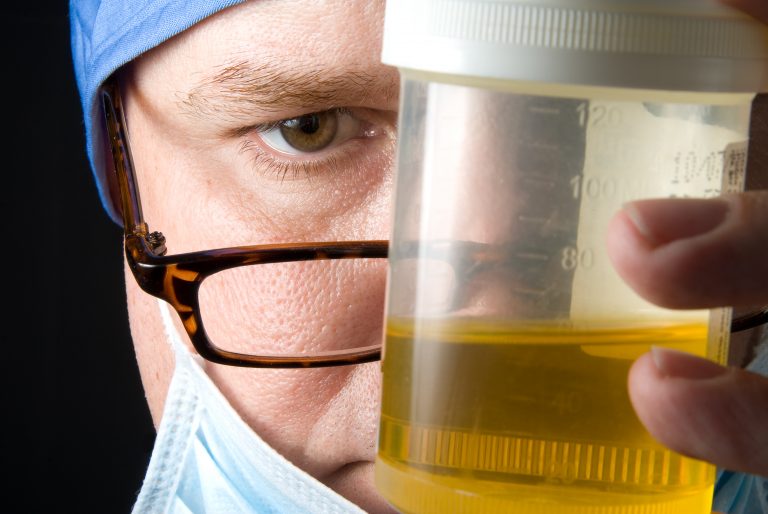 What Your Urine May Be Telling You