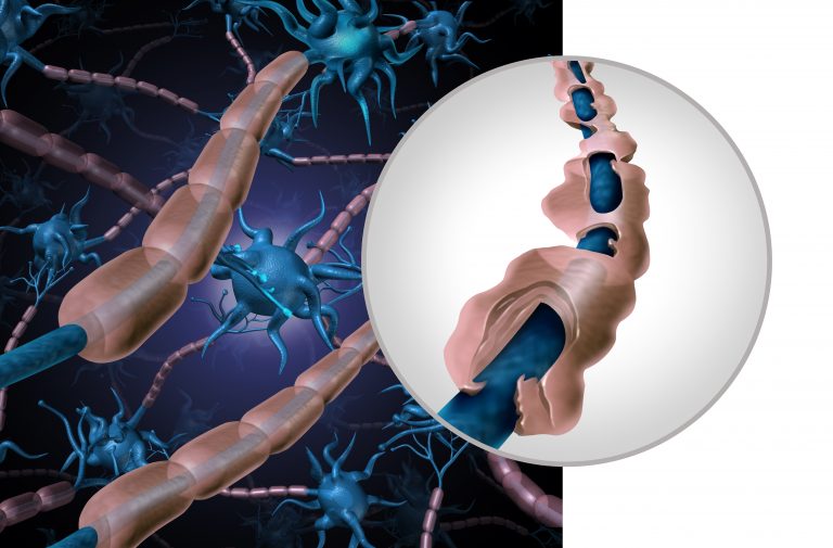 Naturally Protect Myelin Sheath to Support Your Aging Brain