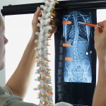 Scoliosis Stretches that Work