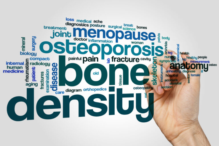 3 Natural Treatments to Improve Bone Density