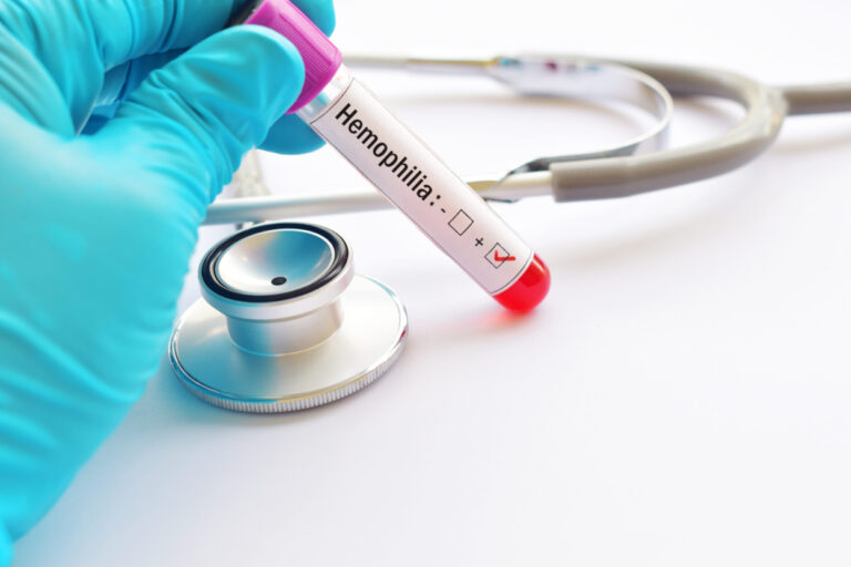 Hemophilia: Symptoms and Treatment Options